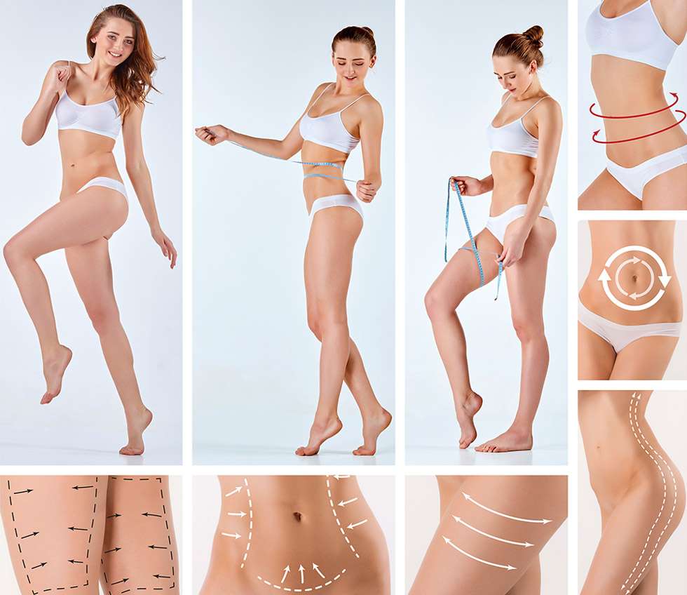 Fettabsaugung am Bauch – BodenseeKlinik