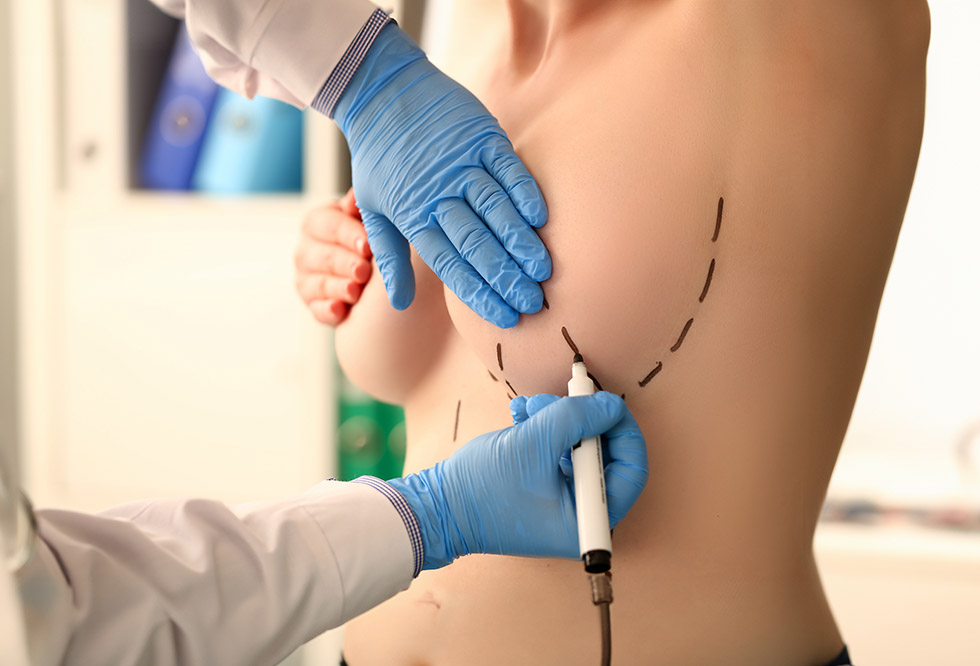 Was ist ein Lipofilling der Lippen?<br />
